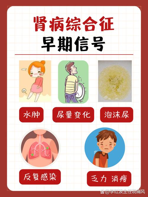 儿童肾炎早期症状有哪些？-第1张图片-中州医学会