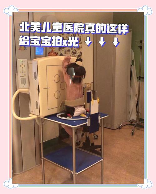 新生儿照X光会影响健康吗？-第2张图片-中州医学会