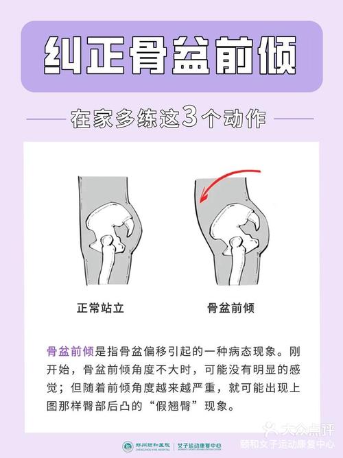 儿童纠正骨盆前倾最佳方法-第1张图片-中州医学会