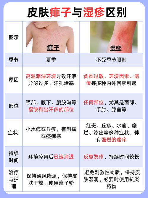 新生儿湿疹和痱子图片如何区分？-第2张图片-中州医学会