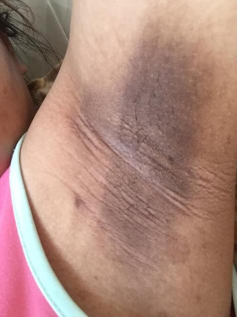 孕期皮肤变黑，怎么有效改善？-第2张图片-中州医学会