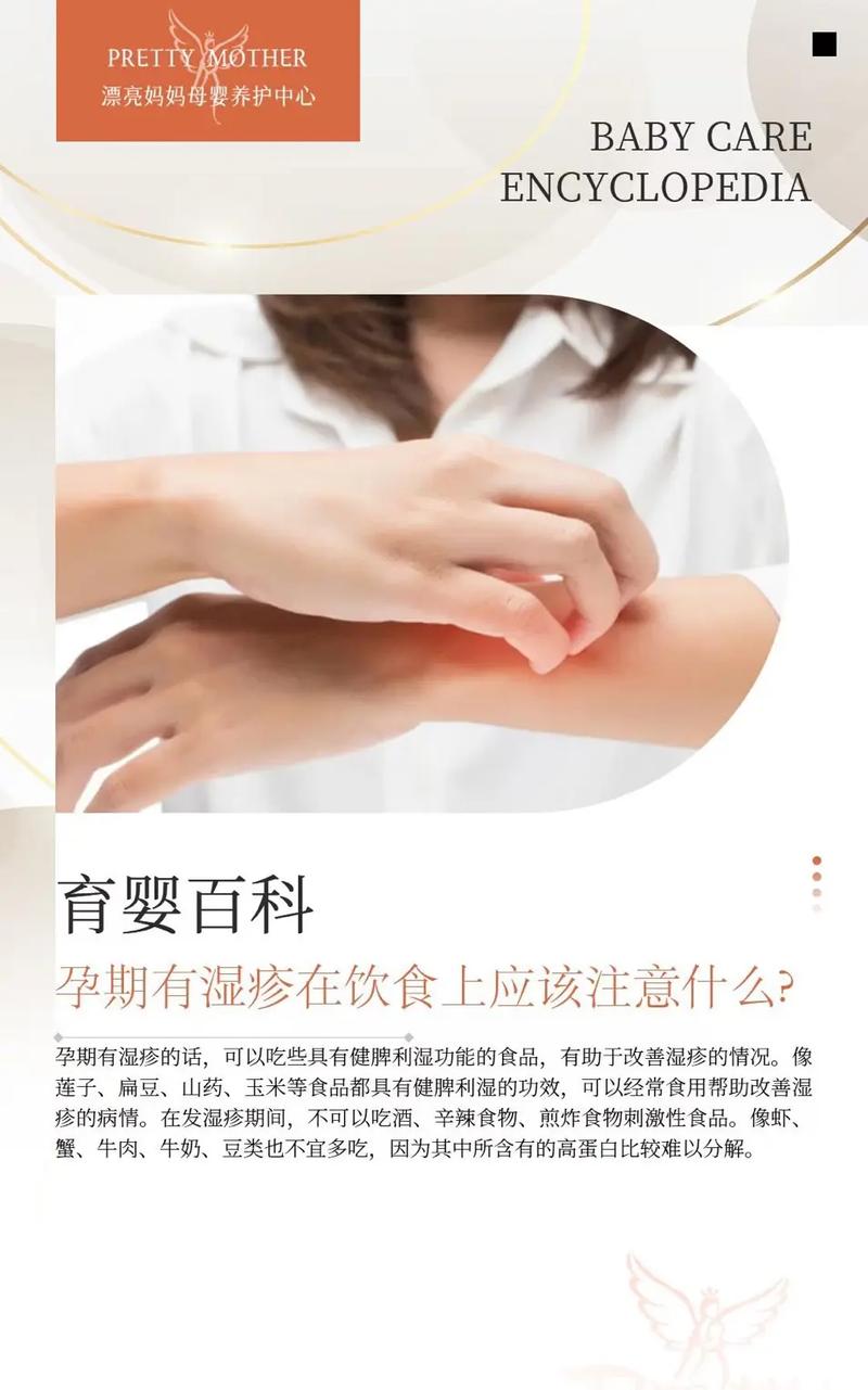 孕期湿疹怎么治？-第3张图片-中州医学会
