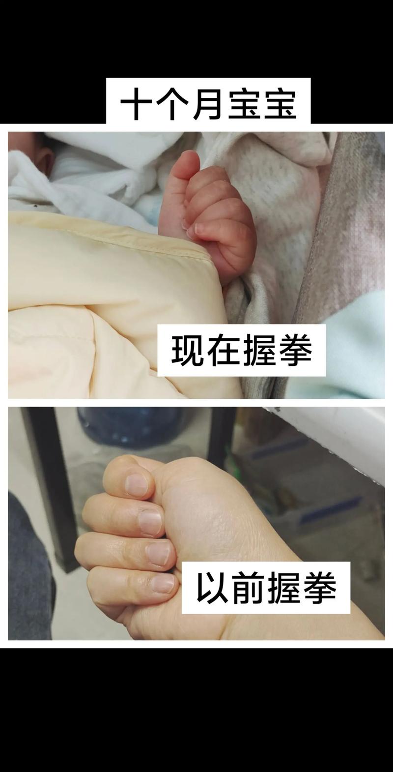 新生儿握拳大拇指内扣正常吗-第3张图片-中州医学会