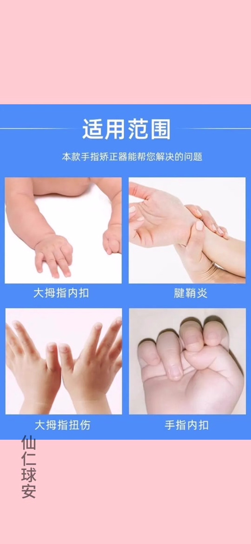 新生儿握拳大拇指内扣正常吗-第2张图片-中州医学会 新生儿握拳大拇指内扣正常吗-第2张图片-中州医学会