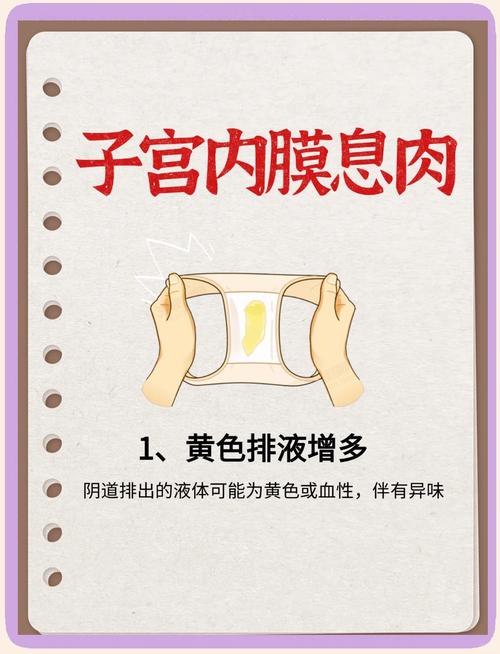 孕期宫颈息肉有何症状?-第1张图片-郑州医学网 孕期宫颈息肉有何症状?-第1张图片-郑州医学网