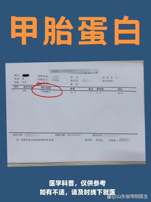 孕期甲胎蛋白1000多要紧吗?-第1张图片-郑州医学网 孕期甲胎蛋白1000多要紧吗?-第1张图片-郑州医学网