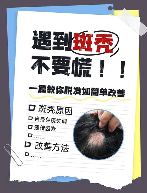 儿童斑秃诱因有哪些?-第3张图片-郑州医学网 儿童斑秃诱因有哪些?-第3张图片-郑州医学网