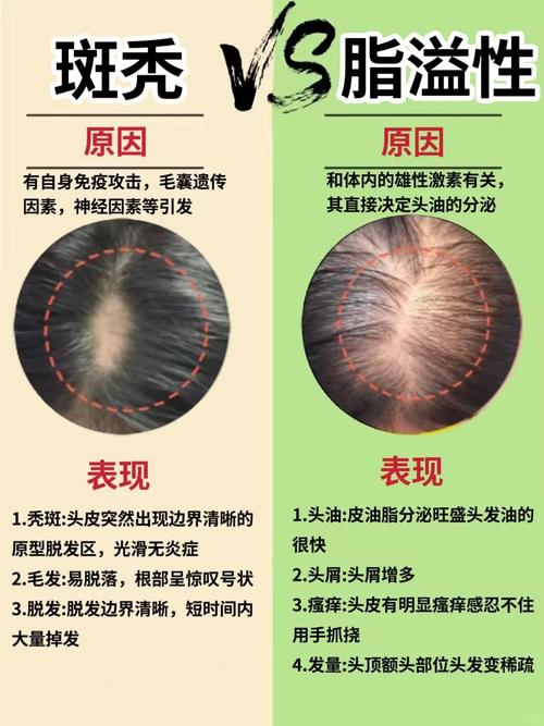 儿童斑秃诱因有哪些?-第1张图片-郑州医学网 儿童斑秃诱因有哪些?-第1张图片-郑州医学网