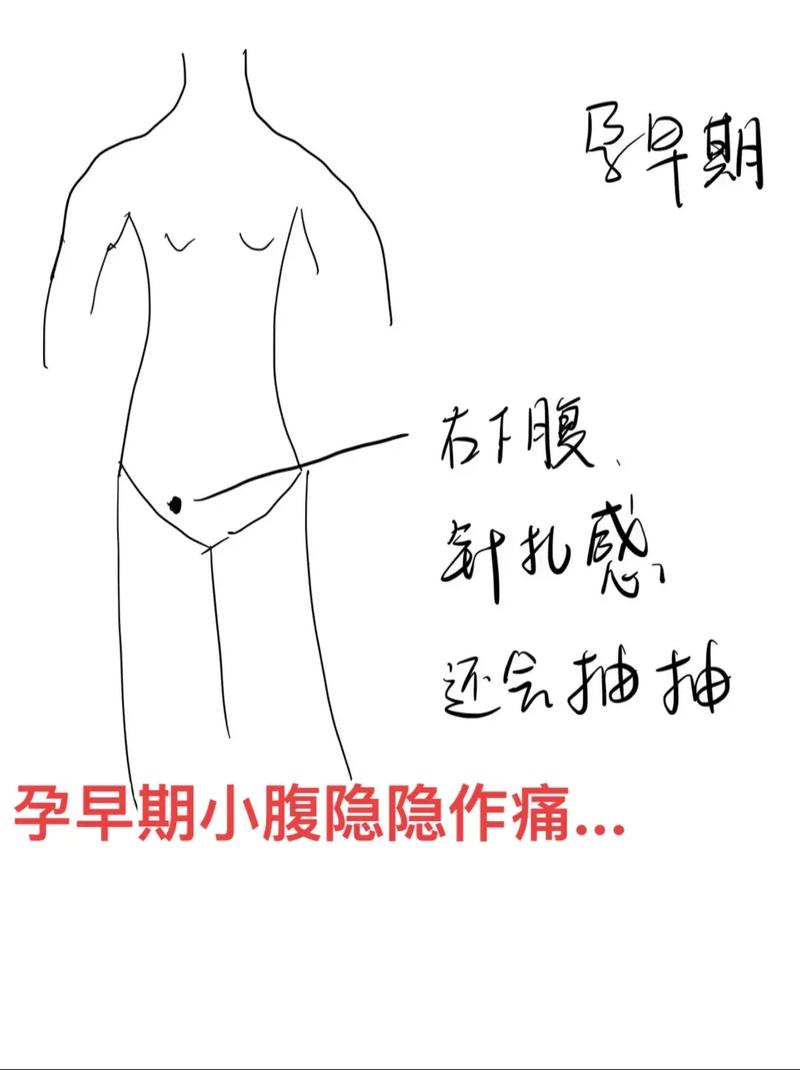 孕期4个月小腹隐隐作痛-第1张图片-中州医学会