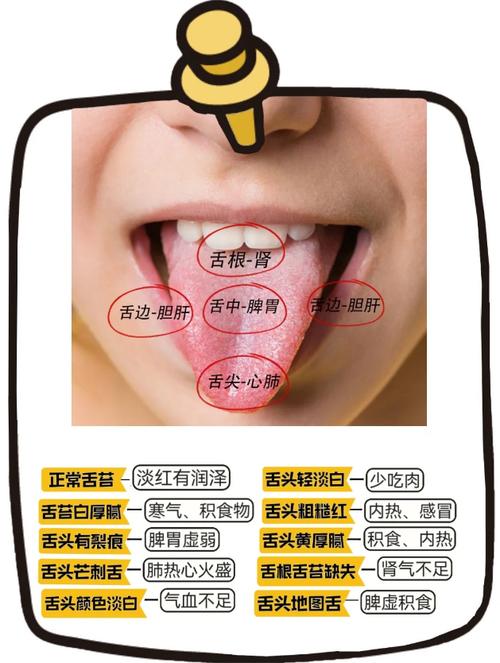 3岁儿童口臭是何原因？-第3张图片-郑州医学网