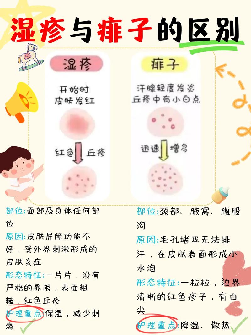 6岁儿童湿疹怎么引起的-第2张图片-郑州医学网 6岁儿童湿疹怎么引起的-第2张图片-郑州医学网