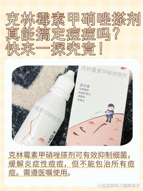 孕期长痘，用药安全吗？-第3张图片-郑州医学网