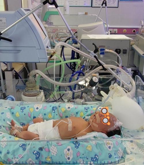 新生儿支气管炎为何需住院?-第3张图片-郑州医学网 新生儿支气管炎为何需住院?-第3张图片-郑州医学网