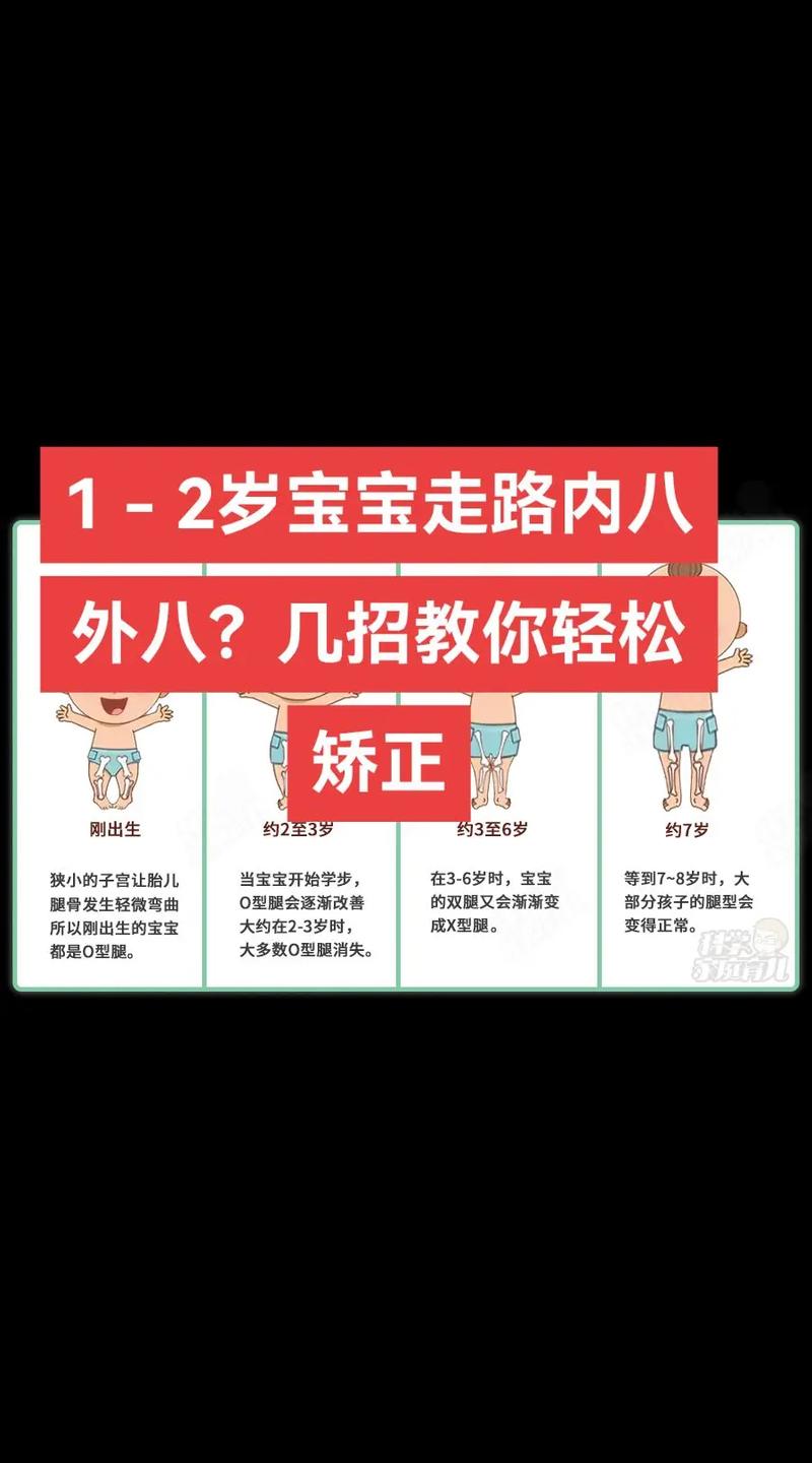 儿童走路姿势异常该挂骨科还是儿童保健科?-第2张图片-郑州医学网 儿童走路姿势异常该挂骨科还是儿童保健科?-第2张图片-郑州医学网