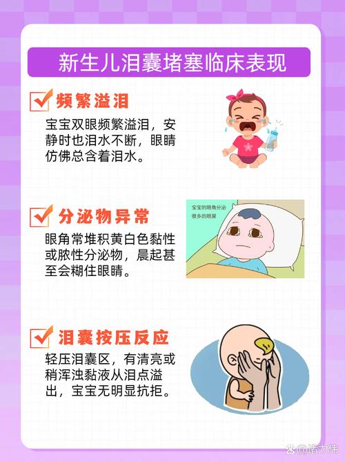 新生儿眼睛黄水流出是正常现象还是异常信号？需警惕哪些眼部疾病风险？-第3张图片-郑州医学网