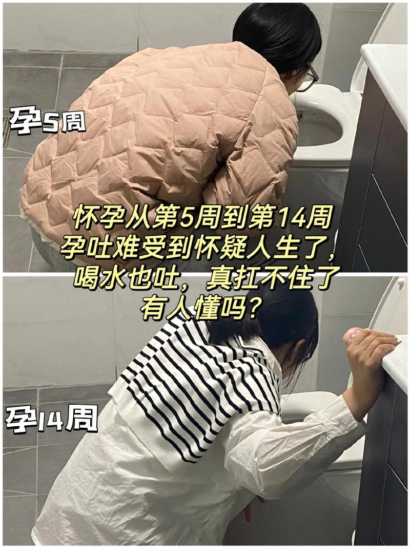 孕期没有呕吐反应，胎儿性别是男是女？科学依据在哪里？-第3张图片-郑州医学网