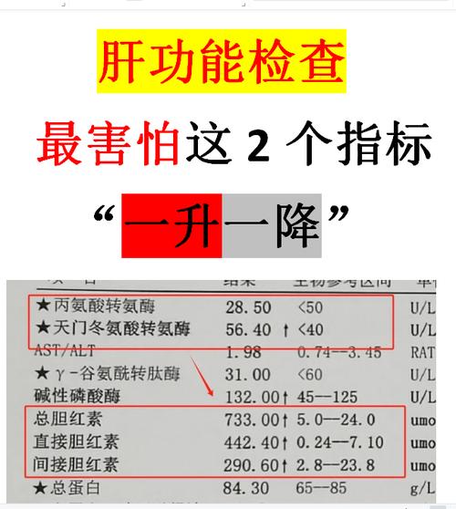 孕期肝功能检查到底有没有必要做？不做会有哪些风险？-第3张图片-郑州医学网