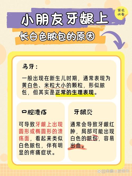 儿童牙龈长脓包该吃什么药？盲目用药会加重感染吗？-第2张图片-郑州医学网