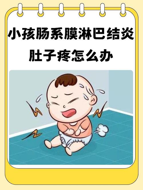 儿童肠系膜淋巴结炎有哪些典型症状？如何区分与普通腹痛？-第2张图片-郑州医学网