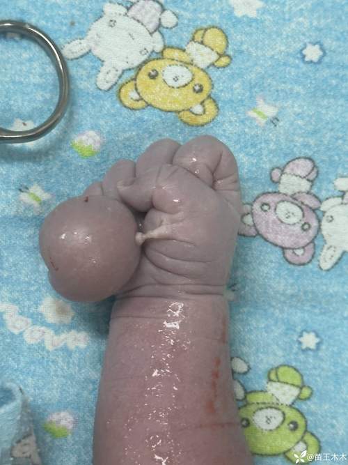 新生儿什么时候能看见东西？他们能看到多远？视力发展要经历哪些阶段？-第3张图片-郑州医学网