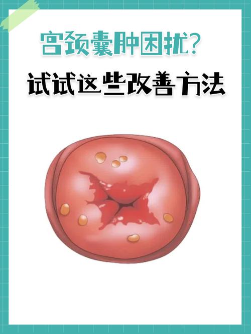 孕期发现宫颈囊肿,会对胎儿有影响吗?需要治疗吗?-第1张图片-郑州医学网 孕期发现宫颈囊肿,会对胎儿有影响吗?需要治疗吗?-第1张图片-郑州医学网