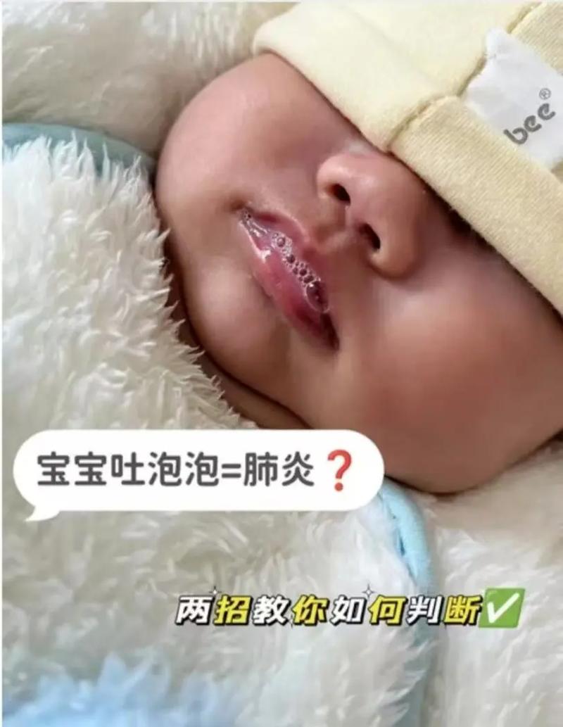 新生儿支气管肺炎吐泡泡是正常现象还是危险信号?-第1张图片-郑州医学网 新生儿支气管肺炎吐泡泡是正常现象还是危险信号?-第1张图片-郑州医学网