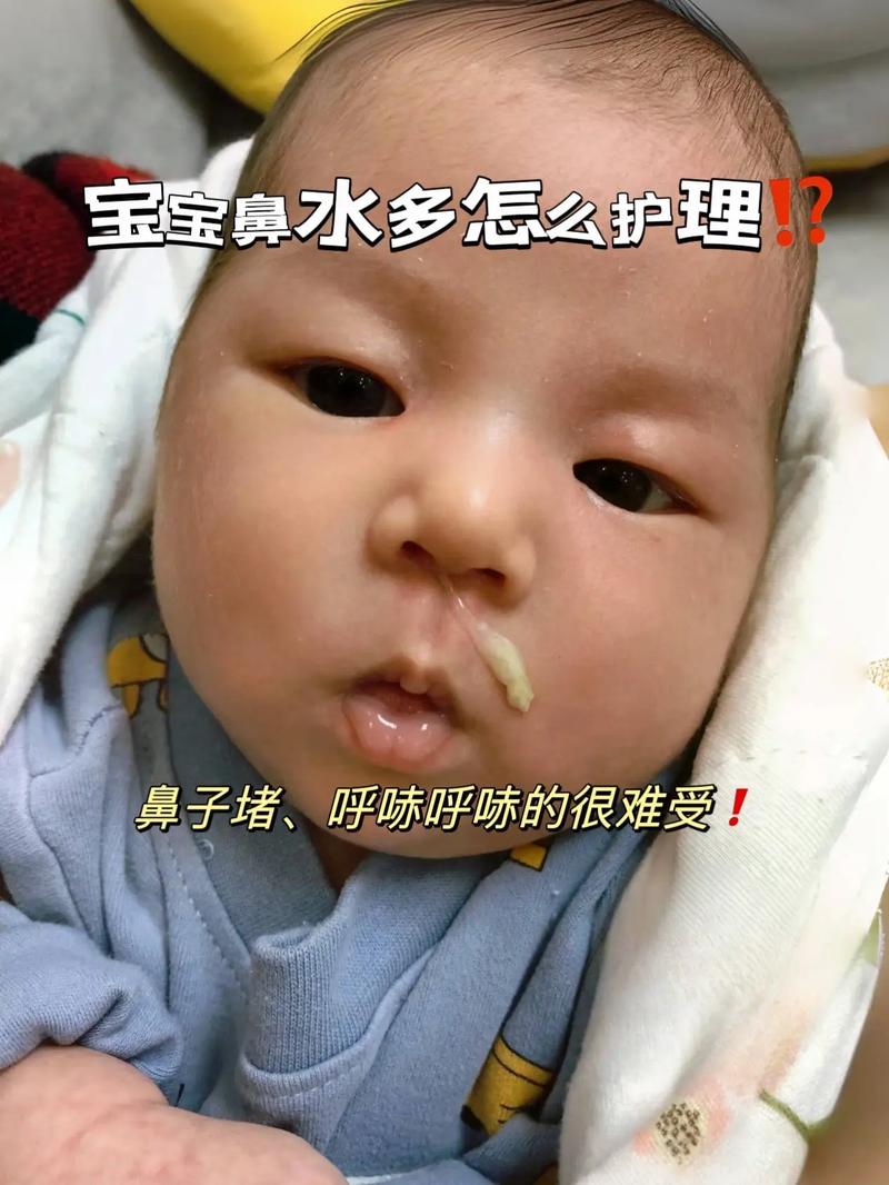 新生儿鼻子发黑是缺氧还是正常现象？需要警惕哪些健康问题？-第2张图片-郑州医学网