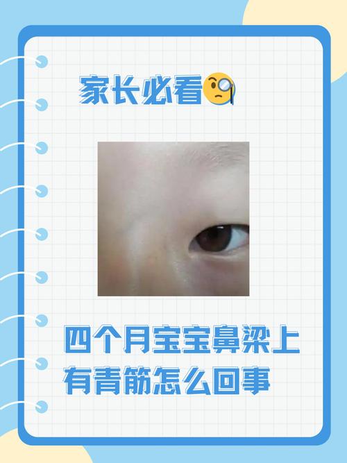 新生儿鼻子发黑是缺氧还是正常现象？需要警惕哪些健康问题？-第1张图片-郑州医学网