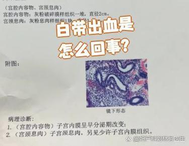 孕期白带有血是危险信号吗？需警惕哪些异常情况？-第2张图片-郑州医学网