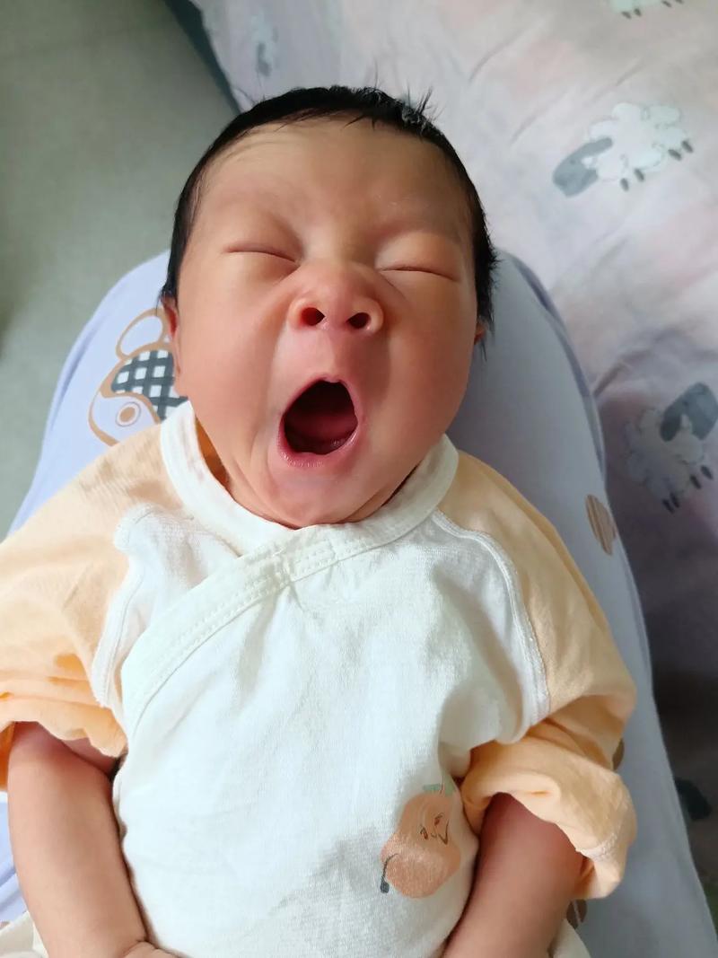 新生儿黄疸300高吗？需要照蓝光吗？会损伤大脑吗？-第3张图片-郑州医学网