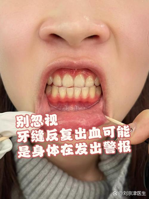 孕期一睡觉就牙龈出血，是正常现象还是身体在发出预警信号？-第2张图片-郑州医学网