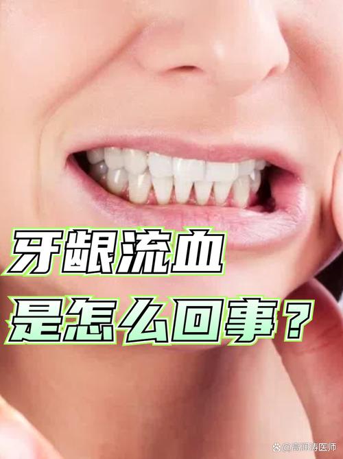 孕期一睡觉就牙龈出血，是正常现象还是身体在发出预警信号？-第3张图片-郑州医学网