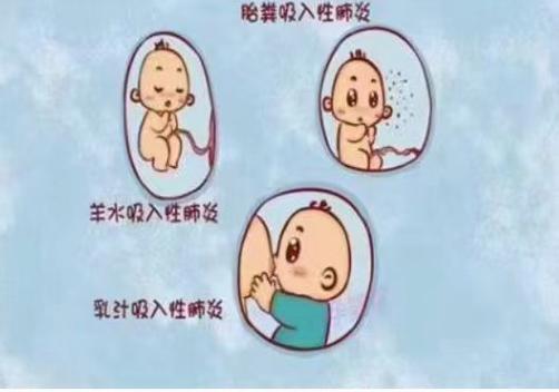 儿童游泳后出现吸入性肺炎，会有哪些典型症状需要家长警惕？-第2张图片-郑州医学网