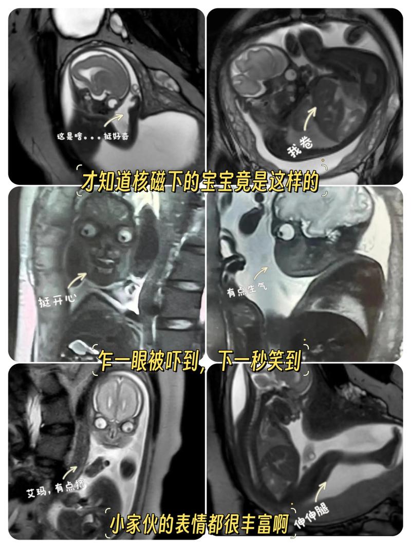 新生儿核磁共振究竟会检查身体哪些部位，能发现哪些潜在问题呢？-第3张图片-郑州医学网