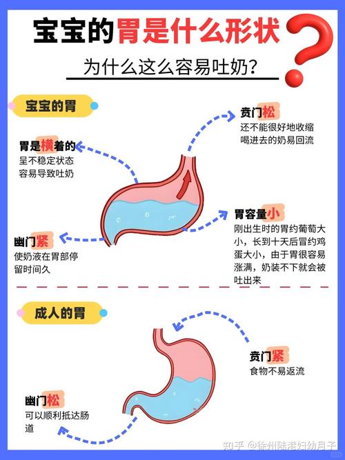新生儿吃奶后频繁吐奶是正常现象还是健康问题？需警惕哪些潜在原因？-第3张图片-郑州医学网
