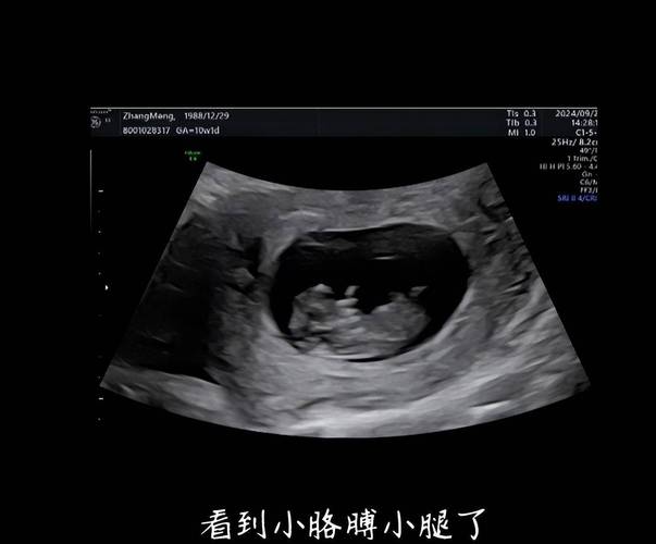 孕期50天B超显示蝌蚪状，是正常胚胎发育还是异常情况？-第1张图片-郑州医学网