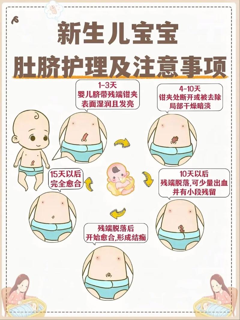 新生儿肚脐出血是正常现象吗？家长该如何正确处理与护理？-第3张图片-郑州医学网