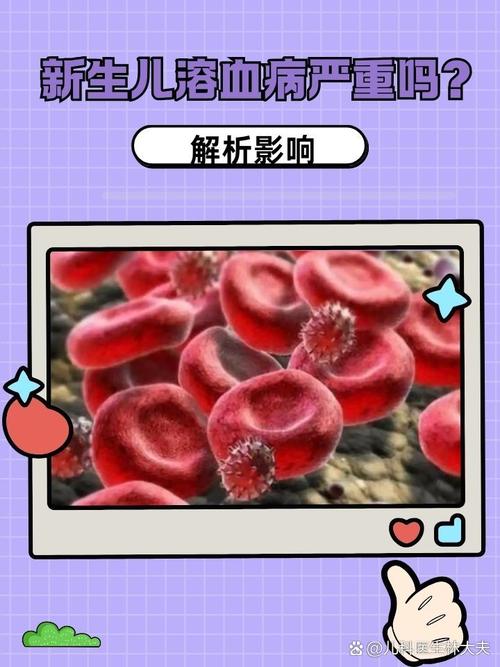 新生儿弥散性血管内凝血的早期识别与干预难点有哪些？-第2张图片-郑州医学网