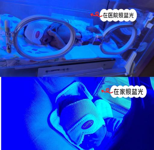 新生儿溶血性黄疸照蓝光，原理是什么？家长需要知道哪些注意事项？-第1张图片-郑州医学网
