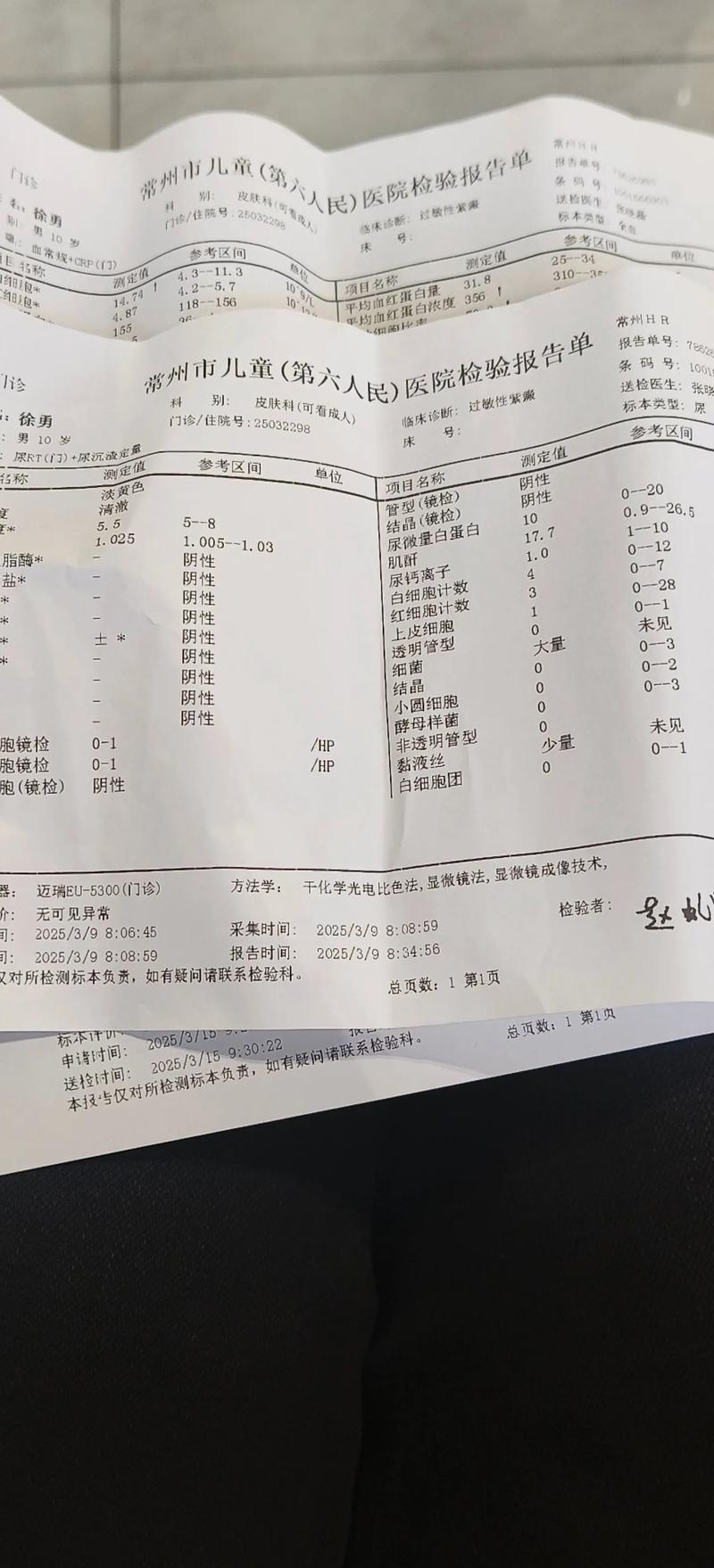 儿童过敏性紫癜治疗关键是什么?激素用药、饮食管理及复发预防全解析-第1张图片-郑州医学网 儿童过敏性紫癜治疗关键是什么?激素用药、饮食管理及复发预防全解析-第1张图片-郑州医学网