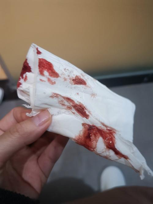 孕妇怀孕期间同床流血是先兆流产信号吗？需要立即就医检查吗？-第2张图片-郑州医学网