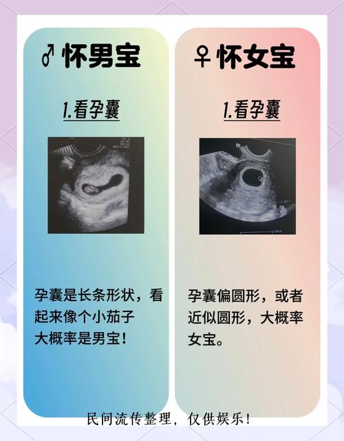 孕期看男女的科学方法有哪些？传统经验靠谱吗？-第3张图片-郑州医学网