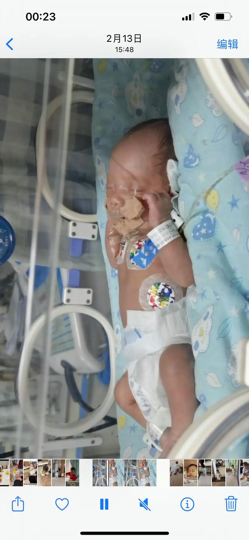 新生儿8天支气管炎真的能自愈吗？家长需警惕哪些潜在风险？-第3张图片-郑州医学网