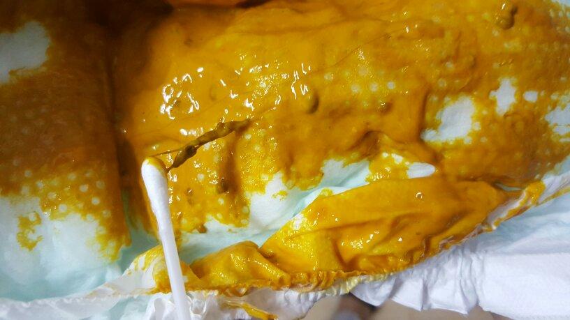 新生儿两天未排便只放屁是攒肚还是便秘？需干预吗？-第1张图片-郑州医学网