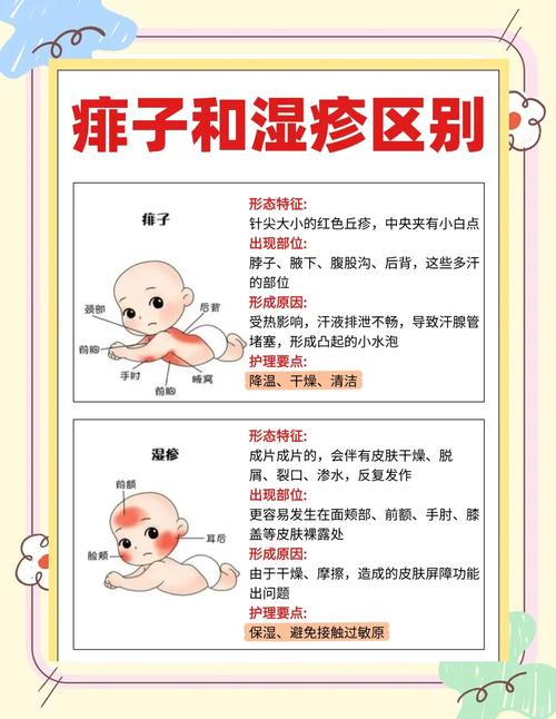 新生儿头上起痱子怎么办？如何正确护理才能快速缓解并避免复发？-第2张图片-郑州医学网
