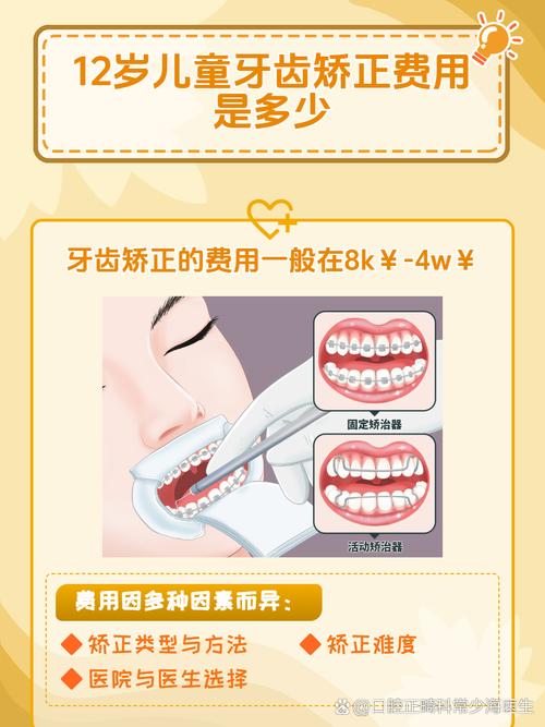 儿童牙齿矫正费用受哪些因素影响？不同矫正方式价格差异有多大？-第2张图片-郑州医学网