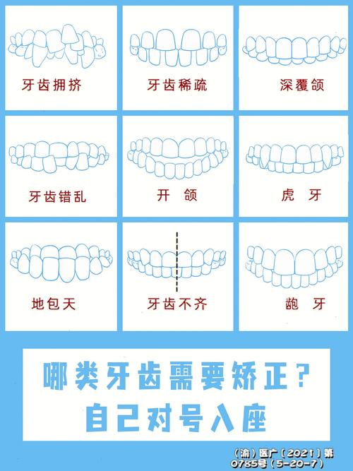 儿童牙齿矫正费用受哪些因素影响?不同矫正方式价格差异有多大?-第3张图片-郑州医学网 儿童牙齿矫正费用受哪些因素影响?不同矫正方式价格差异有多大?-第3张图片-郑州医学网
