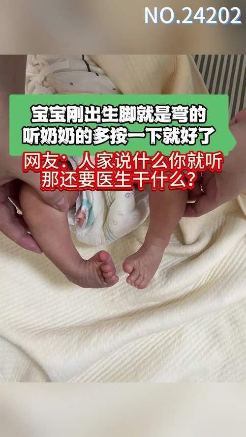 新生儿脚腕弯曲是正常生理现象还是需要警惕的异常信号？-第1张图片-郑州医学网