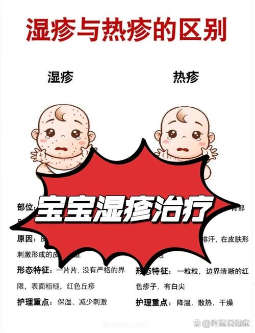 新生儿干燥型湿疹反复发作，到底该怎么护理才能好得快？-第3张图片-郑州医学网