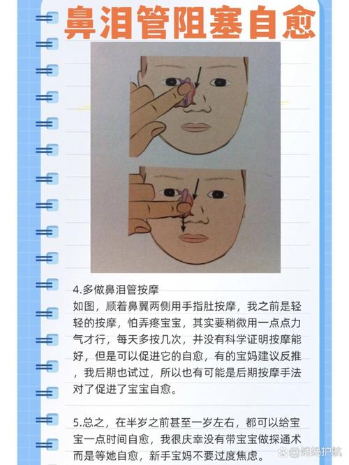 新生儿鼻泪管不通，如何区分生理性与病理性堵塞？-第1张图片-郑州医学网